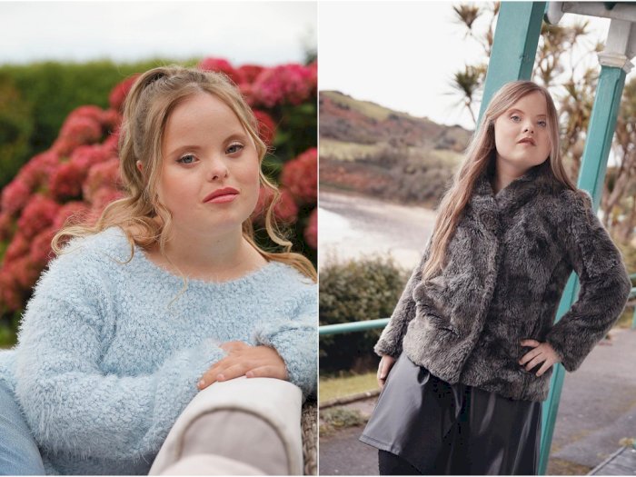 Beth Matthews, gadis penyandang down syndrom yang sukses jadi model. (Instagram/@bethmatthews_zebedee)