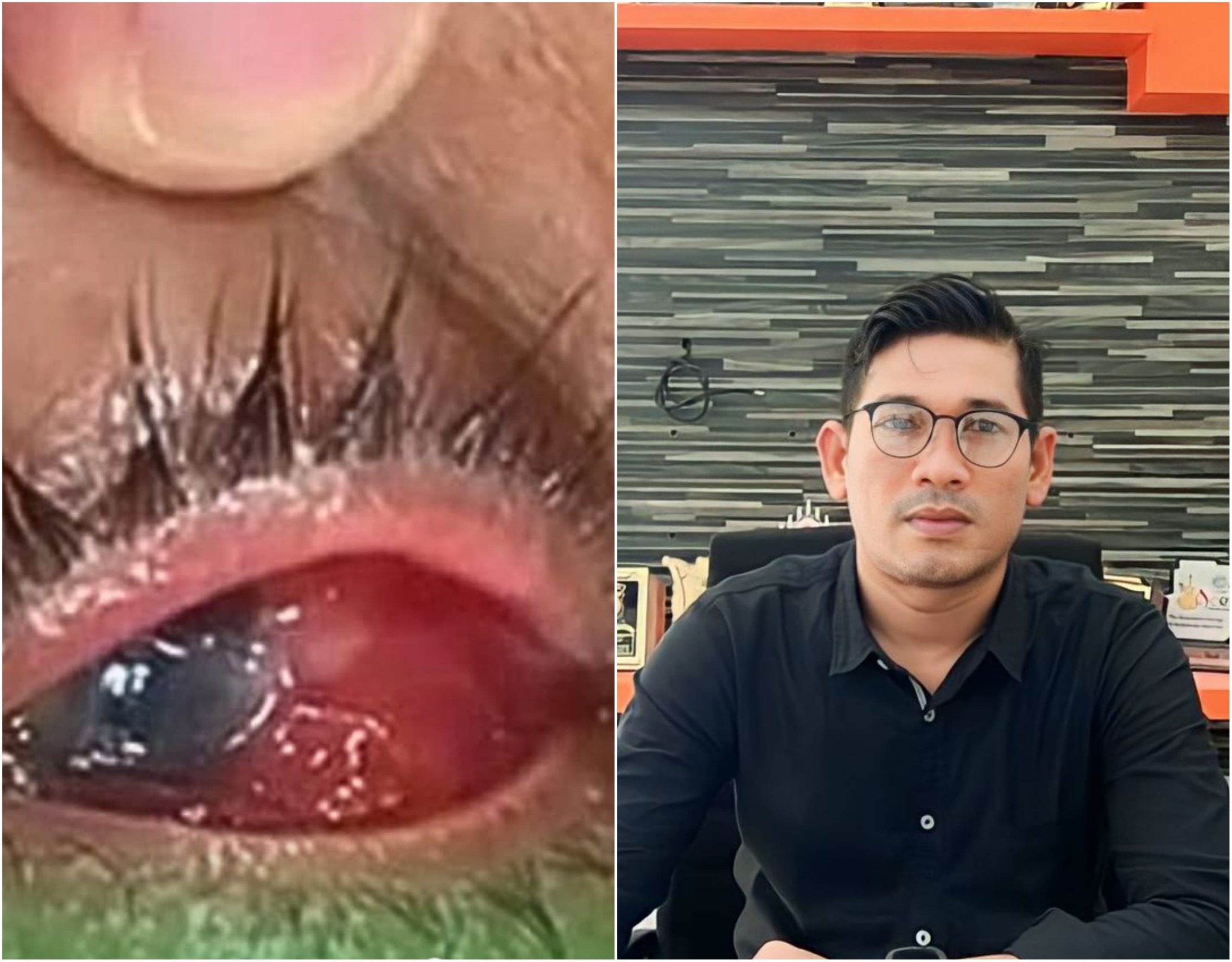 Ketua Yara Aceh Besar, M Nur dan bukti kondisi mata pasien. (Foto: beritamerdeka.net)
