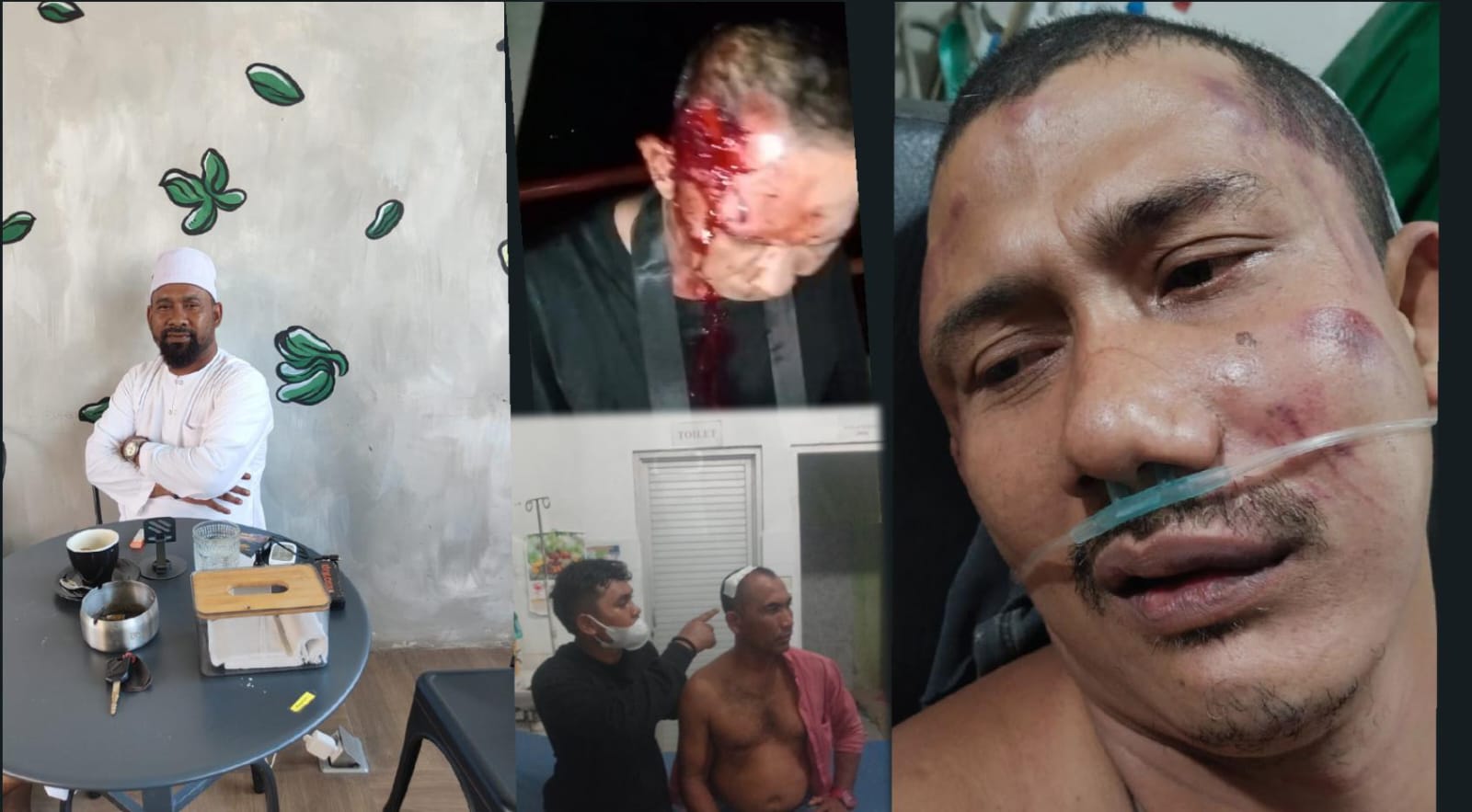 Abu Paya Kareueng Minta Panglima TNI Mencopot Danrem Lilawangsa Usai Dugaan Kekerasan terhadap Warga dan Jurnalis. (Foto: For Nukilan)