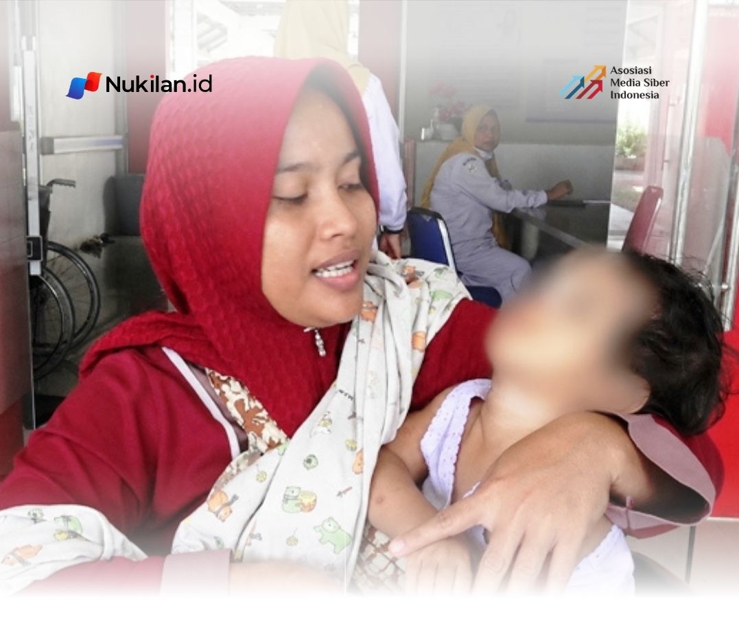 Polres Aceh Timur Gelar Operasi Bibir Sumbing Gratis. (Foto: For Nukilan)