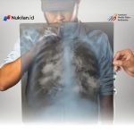 Pengobatan Penyakit Terkait Rokok di Banda Aceh Habiskan Rp113,7 Miliar ROKOK