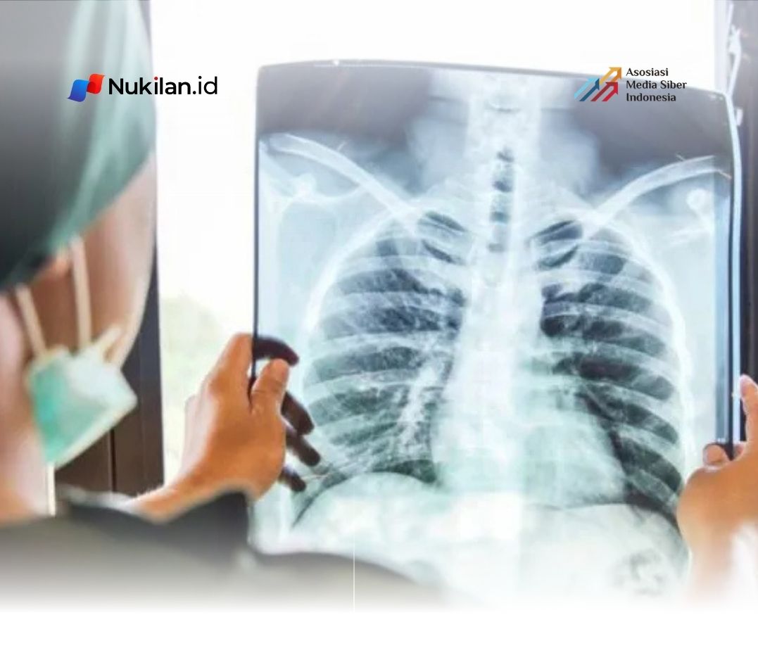 Ilustrasi penyakit akibat rokok. (Foto: hellosehat.com)